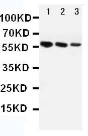 AGT / Angiotensinogen Antibody - WB of AGT / Angiotensinogen antibody. All lanes: Anti-AGT at 0.5ug/ml. Lane 1: Mouse Liver Tissue Lysate at 40ug. Lane 2: Rat Liver Tissue Lysate at 40ug. Lane 3: Rat Cardiac Muscle Tissue Lysate at 40ug. Predicted bind size: 53KD. Observed bind size: 56KD.
