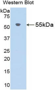 AGT / Angiotensinogen Antibody - Western blot of recombinant AGT / Angiotensinogen.  This image was taken for the unconjugated form of this product. Other forms have not been tested.