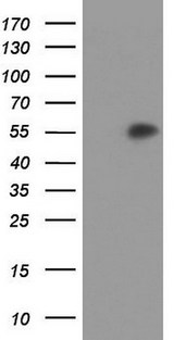 AGT / Angiotensinogen Antibody - HEK293T cells were transfected with the pCMV6-ENTRY control. (Left lane) or pCMV6-ENTRY AGT. (Right lane) cDNA for 48 hrs and lysed. Equivalent amounts of cell lysates. (5 ug per lane) were separated by SDS-PAGE and immunoblotted with anti-AGT.