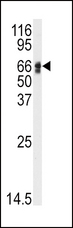 AGT / Angiotensinogen Antibody - Western blot of anti-AGT Antibody in HepG2 cell line lysates (35 ug/lane). AGT(arrow) was detected using the purified antibody.
