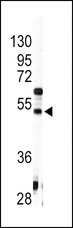 AGT / Angiotensinogen Antibody - Western blot of anti-AGT Antibody in HepG2 cell line lysates (35 ug/lane). AGT (arrow) was detected using the purified antibody.