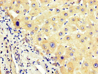 AGT / Angiotensinogen Antibody - IHC image of AGT Antibody diluted at 1:400 and staining in paraffin-embedded human liver tissue performed on a Leica BondTM system. After dewaxing and hydration, antigen retrieval was mediated by high pressure in a citrate buffer (pH 6.0). Section was blocked with 10% normal goat serum 30min at RT. Then primary antibody (1% BSA) was incubated at 4°C overnight. The primary is detected by a biotinylated secondary antibody and visualized using an HRP conjugated SP system.