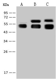 AGT / Angiotensinogen Antibody - Anti-AGT rabbit monoclonal antibody at 1:1000 dilution. Lane A: Mouse spleen tissue lysate. Lane B: Mouse liver tissue lysate. Lane C: Mouse kidney tissue lysate. Lysates/proteins at 30 ug per lane. Secondary: Goat Anti-Rabbit IgG (H+L)/HRP at 1/10000 dilution. Developed using the ECL technique. Performed under reducing conditions. Predicted band size: 51 kDa.