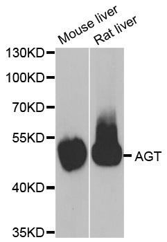 AGT / Angiotensinogen Antibody - Western blot analysis of extracts of various cell lines.