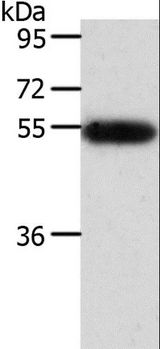 AGT / Angiotensinogen Antibody - Western blot analysis of Human liver cancer tissue, using AGT Polyclonal Antibody at dilution of 1:600.