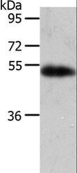 AGT / Angiotensinogen Antibody - Western blot analysis of Human liver cancer tissue, using AGT Polyclonal Antibody at dilution of 1:700.
