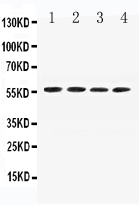 AGT / Angiotensinogen Antibody - Western blot analysis of Angiotensinogen expression in mouse liver extract (lane 1), mouse spleen extract (lane 2), mouse testis extract (lane 3) and mouse kidney extract (lane 4). Angiotensinogen at 56KD was detected using rabbit anti-Angiotensinogen Antigen Affinity purified polyclonal antibody at 0.5 µg/mL. The blot was developed using chemiluminescence (ECL) method.