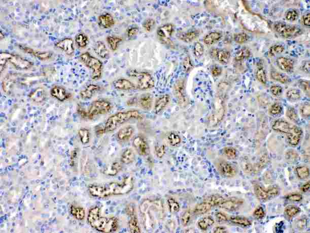 AGT / Angiotensinogen Antibody - Angiotensinogen was detected in paraffin-embedded sections of mouse kidney tissues using rabbit anti-Angiotensinogen Antigen Affinity purified polyclonal antibody at 1 µg/mL. The immunohistochemical section was developed using SABC method
