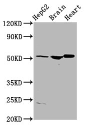 AGT / Angiotensinogen Antibody - Western Blot Positive WB detected in: HepG2 whole cell lysate, Rat brain tissue, Rat heart tissue All Lanes: AGT antibody at 4µg/ml Secondary Goat polyclonal to rabbit IgG at 1/50000 dilution Predicted band size: 54 KDa Observed band size: 54 KDa