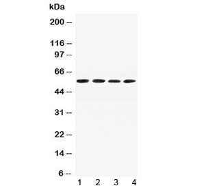 AGT / Angiotensinogen Antibody - Western blot testing of mouse 1) liver, 2) spleen, 3) testis and 4) kidney lysate with Angiotensinogen antibody at 0.5ug/ml. Predicted molecular weight ~56 kDa.