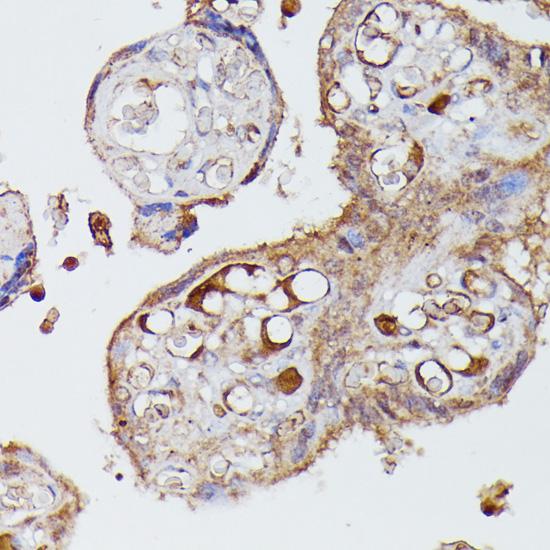 AGT / Angiotensinogen Antibody - Immunohistochemistry of paraffin-embedded Human placenta using AGT Polyclonal Antibody at dilution of 1:100 (40x lens).