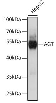 AGT / Angiotensinogen Antibody - Western blot analysis of extracts of HepG2 cells using AGT Polyclonal Antibody at dilution of 1:1000.