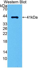 AGTR1 / AT1 Receptor Antibody - Western blot of AGTR1 / AT1 Receptor antibody.