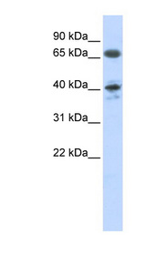 AGTR1 / AT1 Receptor Antibody - AGTR1 antibody Western blot of Fetal Heart lysate. This image was taken for the unconjugated form of this product. Other forms have not been tested.