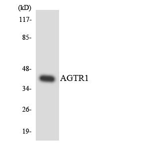 AGTR1 / AT1 Receptor Antibody - Western blot analysis of the lysates from HeLa cells using AGTR1 antibody.