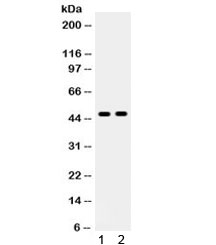 AGTR1 / AT1 Receptor Antibody