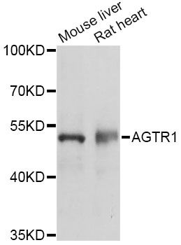 AGTR1 / AT1 Receptor Antibody - Western blot analysis of extracts of various cell lines, using AGTR1 antibody at 1:1000 dilution. The secondary antibody used was an HRP Goat Anti-Rabbit IgG (H+L) at 1:10000 dilution. Lysates were loaded 25ug per lane and 3% nonfat dry milk in TBST was used for blocking. An ECL Kit was used for detection and the exposure time was 90s.