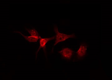 AGTR1 / AT1 Receptor Antibody - Staining HeLa cells by IF/ICC. The samples were fixed with PFA and permeabilized in 0.1% Triton X-100, then blocked in 10% serum for 45 min at 25°C. The primary antibody was diluted at 1:200 and incubated with the sample for 1 hour at 37°C. An Alexa Fluor 594 conjugated goat anti-rabbit IgG (H+L) Ab, diluted at 1/600, was used as the secondary antibody.