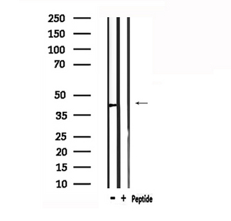 AGTR1 / AT1 Receptor Antibody - Western blot analysis of extracts of rat muscle using AGTR1 antibody.