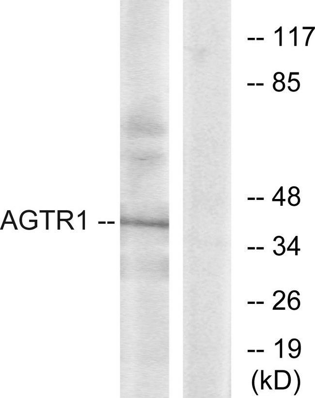 AGTR1 / AT1 Receptor Antibody - Western blot analysis of extracts from K562 cells, using AGTR1 antibody.