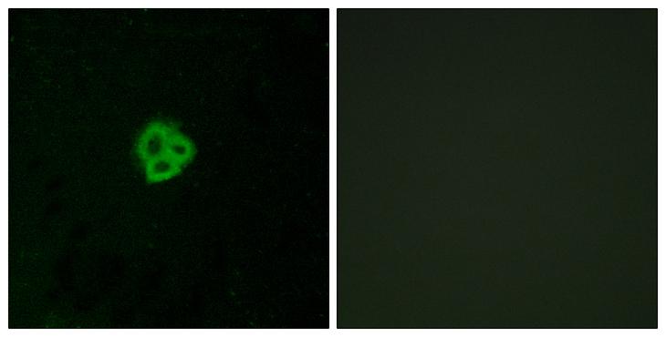 AGTR1 / AT1 Receptor Antibody - Peptide - + Immunofluorescence analysis of MCF-7 cells, using AGTR1 antibody.