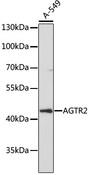 AGTR2 / AT2 Receptor Antibody - Western blot analysis of extracts of A-549 cells using AGTR2 Polyclonal Antibody at dilution of 1:1000.