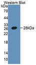 AGXT / SPT Antibody - Western blot of AGXT / SPT antibody.