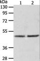 AGXT / SPT Antibody - Western blot analysis of Human fetal liver tissue and hepg2 cell, using AGXT Polyclonal Antibody at dilution of 1:1050.