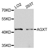 AGXT / SPT Antibody - Western blot analysis of extracts of various cells.