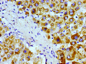 AGXT / SPT Antibody - Immunohistochemistry image of paraffin-embedded human liver tissue at a dilution of 1:100