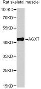 AGXT / SPT Antibody - Western blot analysis of extracts of rat skeletal muscle, using AGXT antibody at 1:1000 dilution. The secondary antibody used was an HRP Goat Anti-Rabbit IgG (H+L) at 1:10000 dilution. Lysates were loaded 25ug per lane and 3% nonfat dry milk in TBST was used for blocking. An ECL Kit was used for detection and the exposure time was 10s.