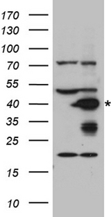 AGXT / SPT Antibody - HEK293T cells were transfected with the pCMV6-ENTRY control. (Left lane) or pCMV6-ENTRY AGXT. (Right lane) cDNA for 48 hrs and lysed