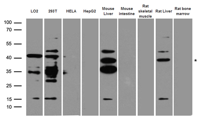 AGXT / SPT Antibody - Western blot analysis of extracts. (35ug) from different cell lines and tissues by using anti-AGXT rabbit polyclonal antibody.