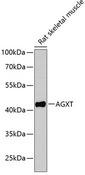 AGXT / SPT Antibody - Western blot analysis of extracts of rat skeletal muscle using AGXT Polyclonal Antibody at dilution of 1:1000.