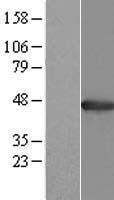 AGXT / SPT Protein - Western validation with an anti-DDK antibody * L: Control HEK293 lysate R: Over-expression lysate