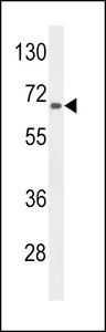 AGXT2 Antibody - Western blot of lysate from HepG2 cell line, using AGXT2 Antibody. Antibody was diluted at 1:1000 at each lane. A goat anti-rabbit IgG H&L (HRP) at 1:5000 dilution was used as the secondary antibody. Lysate at 35ug per lane.