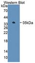 AGXT2 Antibody - Western Blot; Sample: Recombinant protein.