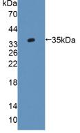 AGXT2 Antibody - Western Blot; Sample: Recombinant AGXT2, Rat.