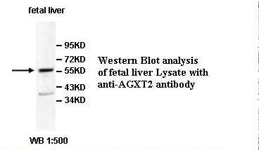 AGXT2 Antibody