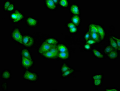 AGXT2 Antibody - Immunofluorescence staining of HepG2 cells at a dilution of 1:233, counter-stained with DAPI. The cells were fixed in 4% formaldehyde, permeabilized using 0.2% Triton X-100 and blocked in 10% normal Goat Serum. The cells were then incubated with the antibody overnight at 4 °C.The secondary antibody was Alexa Fluor 488-congugated AffiniPure Goat Anti-Rabbit IgG (H+L) .