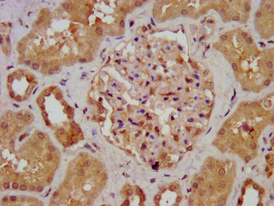AGXT2 Antibody - IHC image of AGXT2 Antibody diluted at 1:700 and staining in paraffin-embedded human kidney tissue performed on a Leica BondTM system. After dewaxing and hydration, antigen retrieval was mediated by high pressure in a citrate buffer (pH 6.0). Section was blocked with 10% normal goat serum 30min at RT. Then primary antibody (1% BSA) was incubated at 4°C overnight. The primary is detected by a biotinylated secondary antibody and visualized using an HRP conjugated SP system.