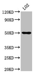 AGXT2 Antibody - Western Blot Positive WB detected in: LO2 whole cell lysate All lanes: AGXT2 antibody at 4.9µg/ml Secondary Goat polyclonal to rabbit IgG at 1/50000 dilution Predicted band size: 58, 50 kDa Observed band size: 50 kDa