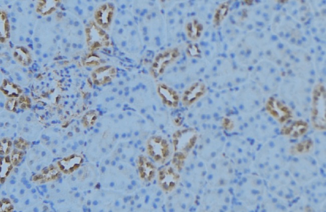 AGXT2 Antibody - 1:100 staining mouse kidney tissue by IHC-P. The sample was formaldehyde fixed and a heat mediated antigen retrieval step in citrate buffer was performed. The sample was then blocked and incubated with the antibody for 1.5 hours at 22°C. An HRP conjugated goat anti-rabbit antibody was used as the secondary.