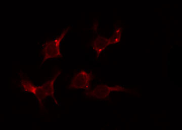 AGXT2 Antibody - Staining LOVO cells by IF/ICC. The samples were fixed with PFA and permeabilized in 0.1% Triton X-100, then blocked in 10% serum for 45 min at 25°C. The primary antibody was diluted at 1:200 and incubated with the sample for 1 hour at 37°C. An Alexa Fluor 594 conjugated goat anti-rabbit IgG (H+L) Ab, diluted at 1/600, was used as the secondary antibody.