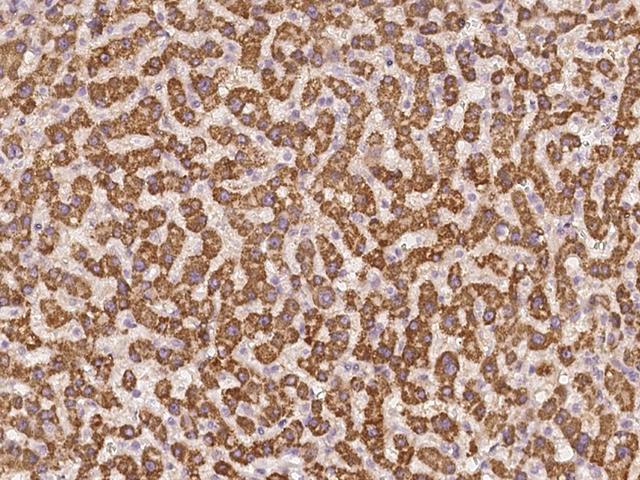 AGXT2 Antibody - Immunochemical staining of human AGXT2 in human liver with rabbit polyclonal antibody at 1:500 dilution, formalin-fixed paraffin embedded sections.