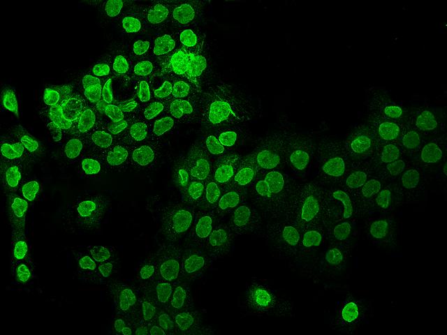 AHCTF1 / ELYS Antibody - Immunofluorescence staining of AHCTF1 in A431 cells. Cells were fixed with 4% PFA, permeabilzed with 0.1% Triton X-100 in PBS, blocked with 10% serum, and incubated with rabbit anti-Human AHCTF1 polyclonal antibody (dilution ratio 1:200) at 4°C overnight. Then cells were stained with the Alexa Fluor 488-conjugated Goat Anti-rabbit IgG secondary antibody (green). Positive staining was localized to Nuclear membrane.