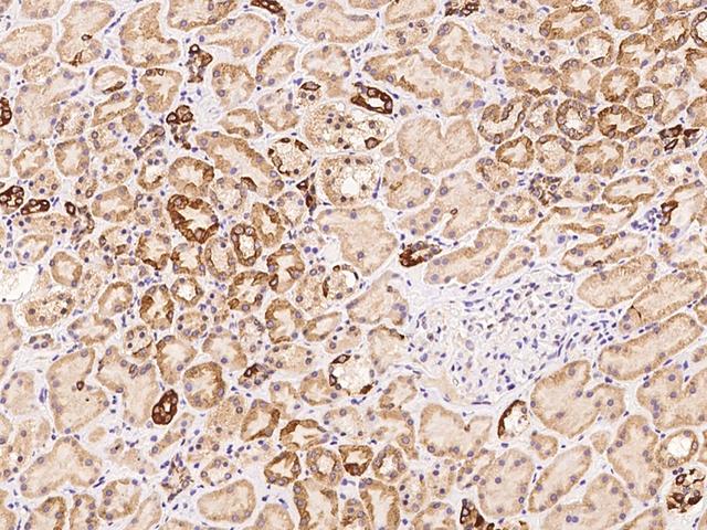 AHCTF1 / ELYS Antibody - Immunochemical staining of human AHCTF1 in human kidney with rabbit polyclonal antibody at 1:100 dilution, formalin-fixed paraffin embedded sections.