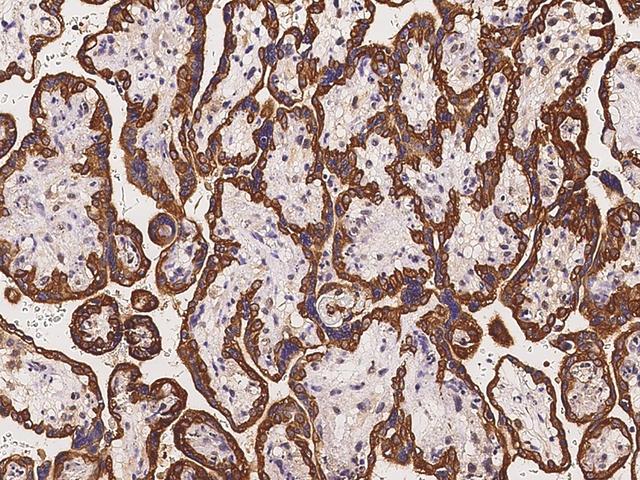 AHCTF1 / ELYS Antibody - Immunochemical staining of human AHCTF1 in human placenta with rabbit polyclonal antibody at 1:100 dilution, formalin-fixed paraffin embedded sections.