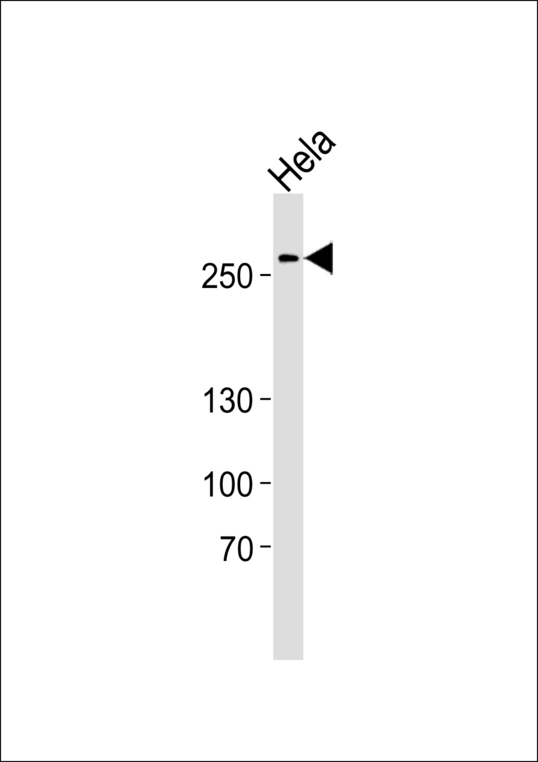 AHCTF1 / ELYS Antibody - Western blot of lysate from HeLa cell line with Phospho-human-AHCTF1 (S1232). control. Antibody was diluted at 1:1000. A goat anti-rabbit IgG H&L (HRP) at 1:5000 dilution was used as the secondary antibody. Lysate at 35 ug.
