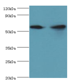 AHCYL1 / DCAL Antibody - Western blot. All lanes: AHCYL1 antibody at 12 ug/ml. Lane 1: HeLa whole cell lysate. Lane 2: 293T whole cell lysate. Secondary antibody: Goat polyclonal to rabbit at 1:10000 dilution. Predicted band size: 59 kDa. Observed band size: 59 kDa.